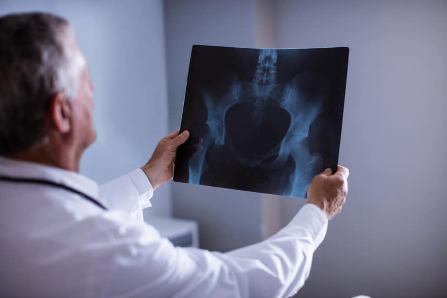 radiologie - radiografie bazin