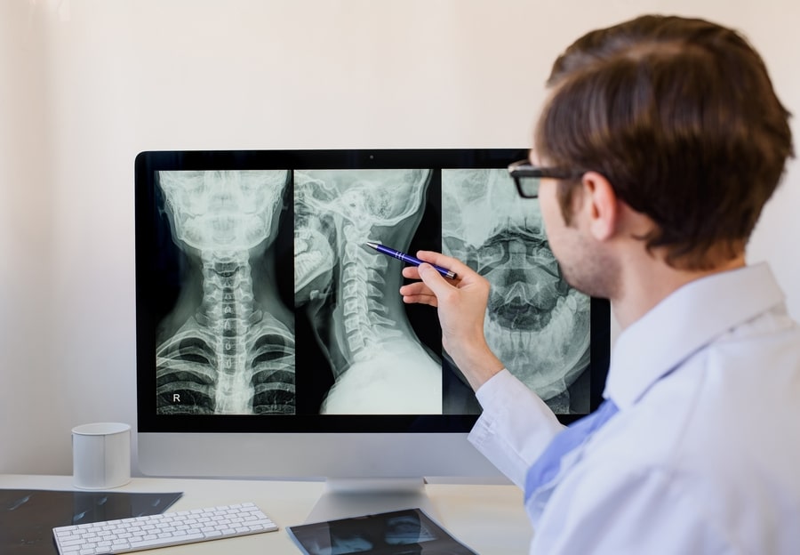 radiologie - radiografie coloana cervicala