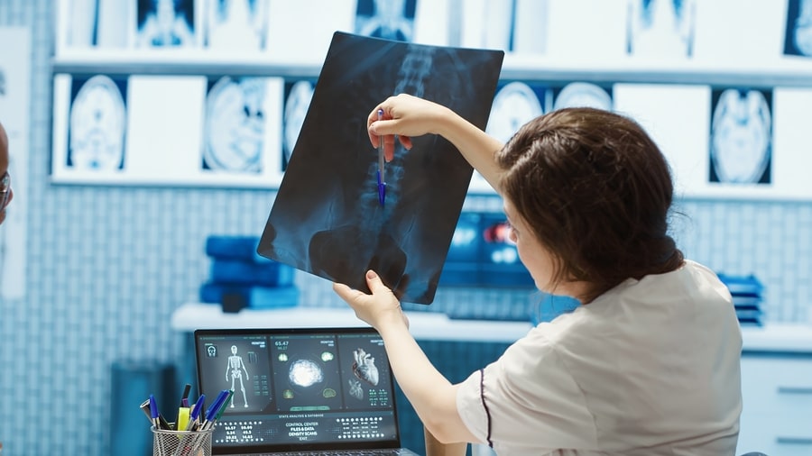 radiologie - radiografie coloana lombara