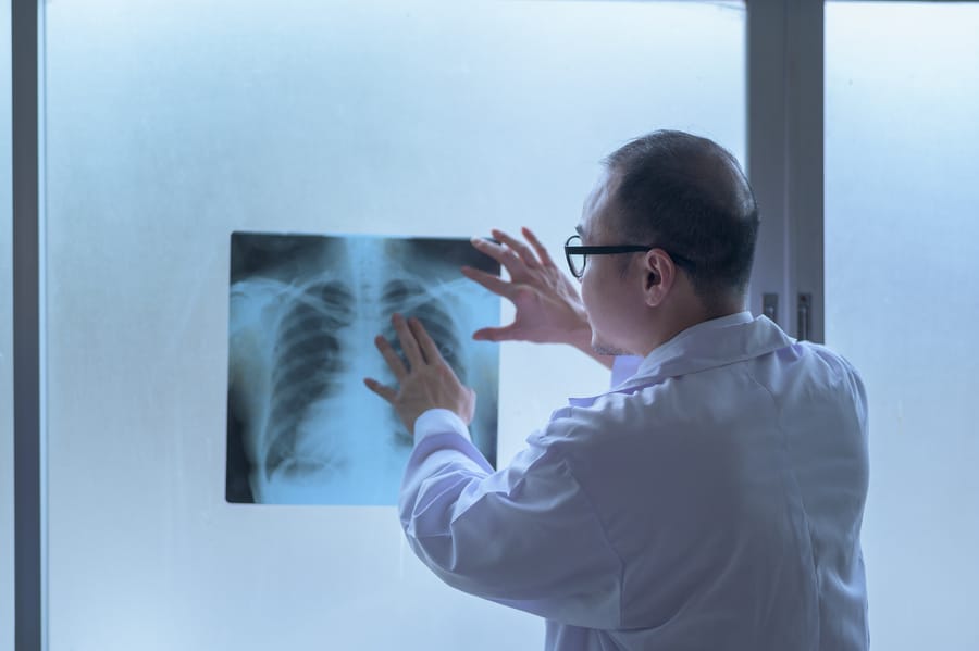 radiologie - radiografie coloana toracala