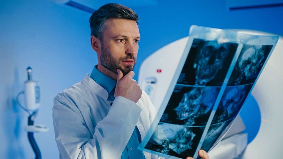 radiologie - radiografie craniana