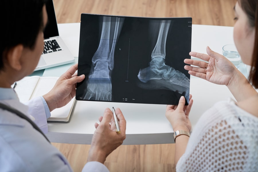 radiologie - radiografie membru inferior