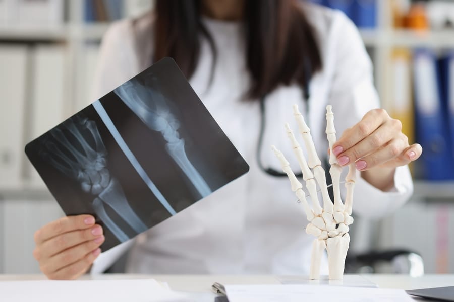 radiologie - radiografie membru superior