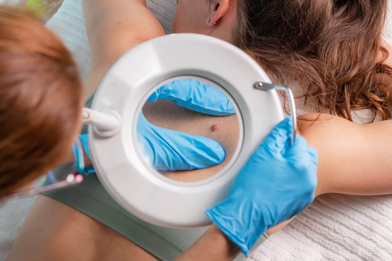 7 cazuri în care micuțul tău are nevoie de un dermatolog pediatru