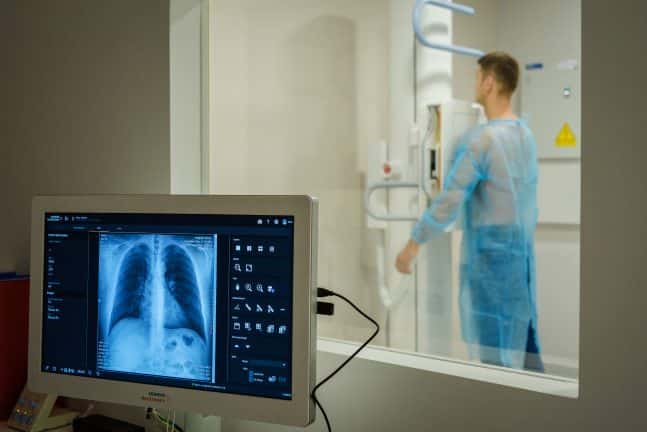 Cum te ajută o radiografie pulmonară să te bucuri de fiecare inspirație