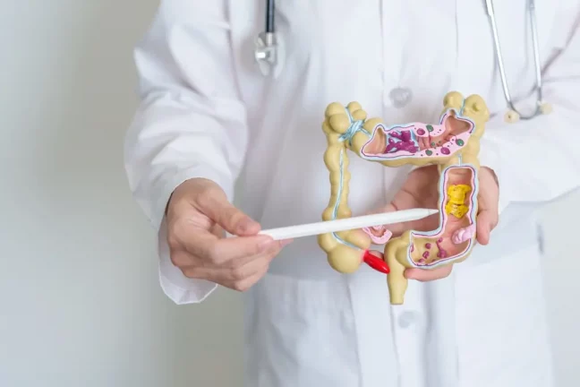 medic explica sindromul de intestin iritabil