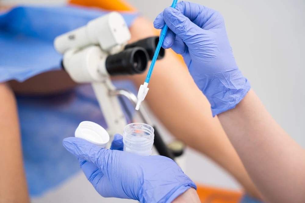 medic ginecolog recolteaza o proba pentru analize