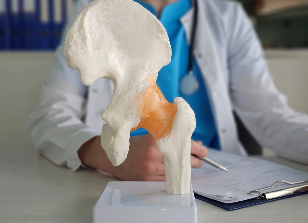 Medic și model anatomic al șoldului